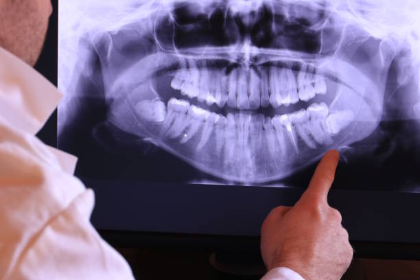 Best Broken or Chipped Tooth Repair in Moroni, UT