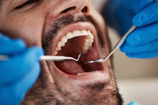 Best Dental Abscess Treatment in Moroni, UT