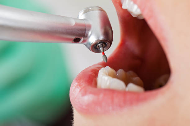 Best Emergency Treatment for Oral Infections in Moroni, UT